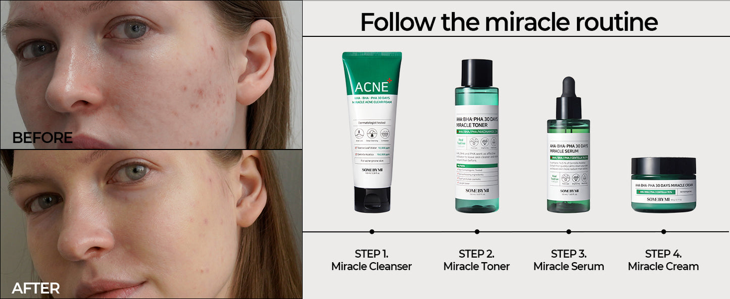 SOMEBYMI AHA-BHA-PHA 30 days Miracle Acne Clear Foam 100ml / 3.38 oz.