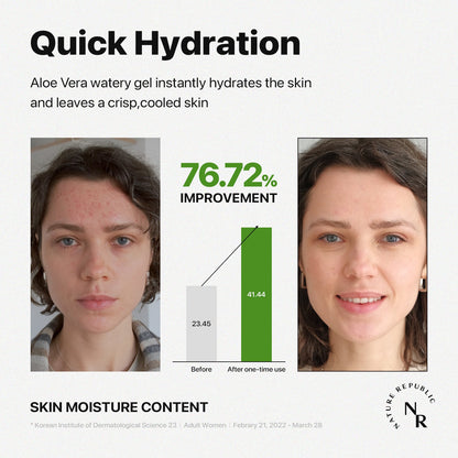 NATURE REPUBLIC Mild & Moisture Aloe Vera Watery Gel 300ml / 10.56 fl. oz.